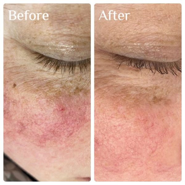 Skin Classic – ReNu You Med Spa